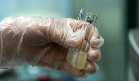 冷冻卵子时要保证完美